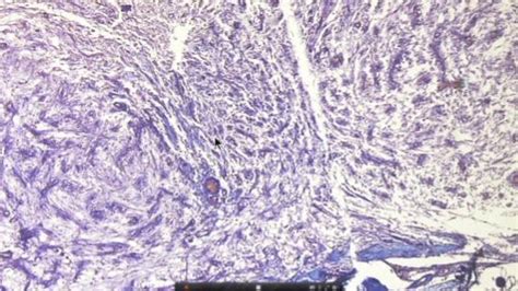 Histology of the Neurohypophysis Diagram | Quizlet