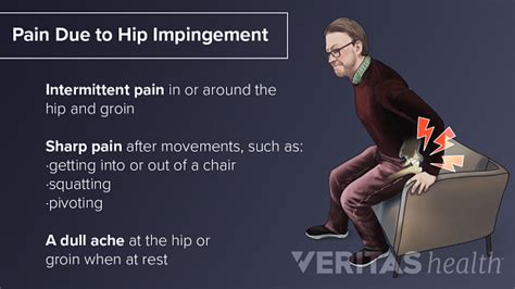 Hip Impingement Symptoms