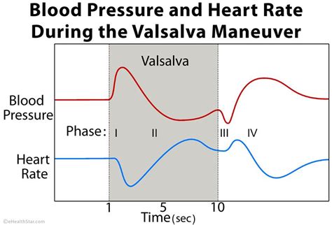 Valsalva Maneuver Headache - Headache