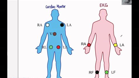 EKG 01: How to perform an EKG - YouTube