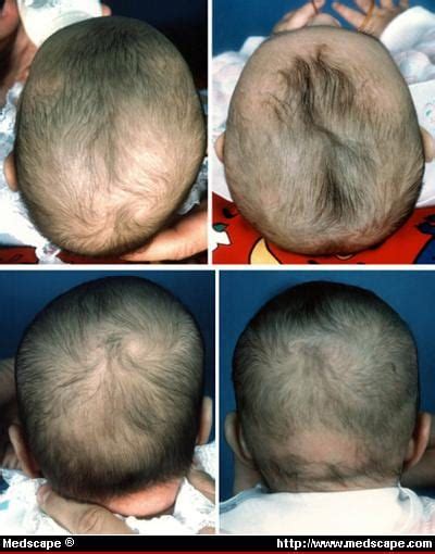 Lopsided head | BabyCenter