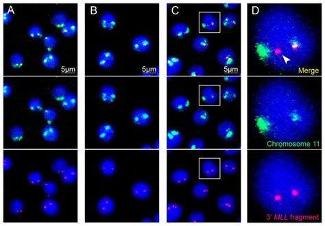 Confocal images of cells made using the 3D-FISH technique; blue colour ...