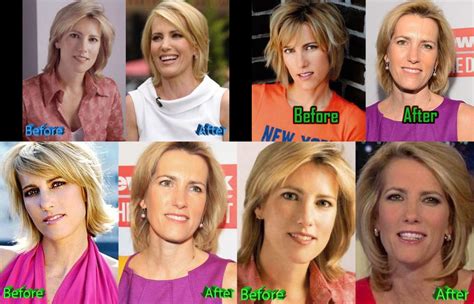 Laura Ingraham before and after plastic surgery. : u/Conscious-Climate-80