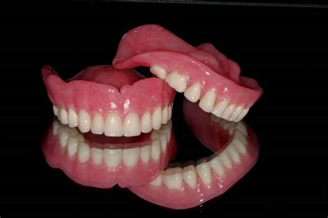 Dentures - Newmarket Road Dental Clinic | Dentists Norwich