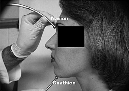 Total face height (nasion-gnathion: n-gn). | Download Scientific Diagram