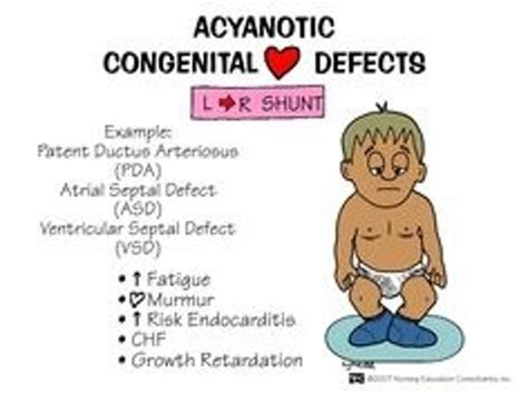 Exemplar 16.B Congenital Heart Defects Flashcards | Quizlet