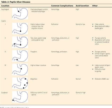 Billroth II procedure—antrectomy and gastrojejunostomy - Semantic Scholar