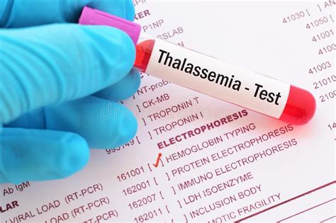 Genetic carrier testing is the key to reducing occurrence of Thalassemia