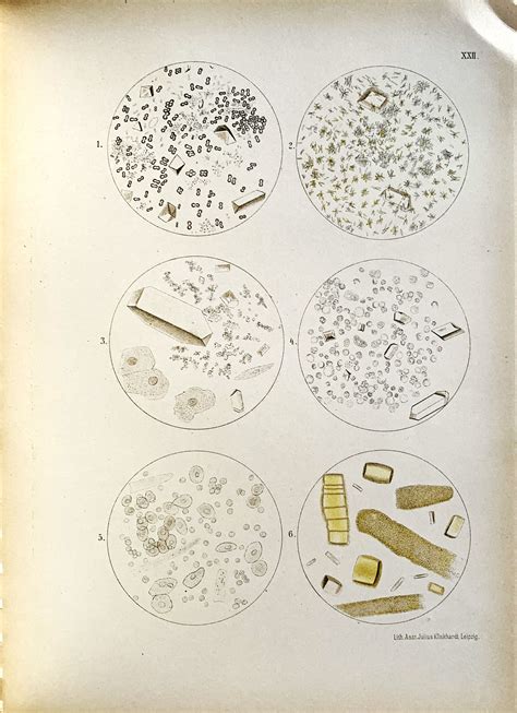 Atlas of Urinary Sediments; with special reference to their clinical ...