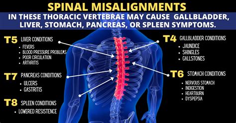 A Thoracic... - Advanced Physical Medicine & Rehab of Miami | Facebook