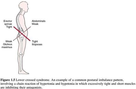 Muscle Energy Techniques (MET): Introduction • Chiropractic Scientist