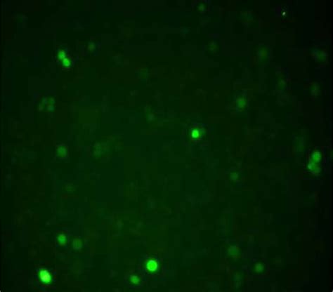 Morphology of K562/A02 cells after transfected for 48 hours under ...