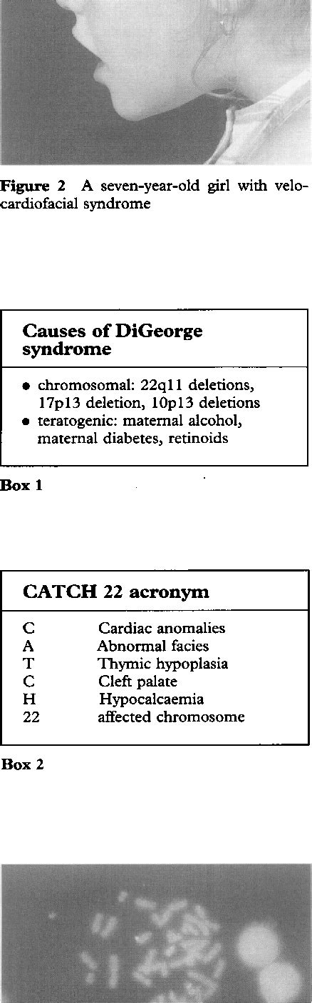 Figure 1 from Genetics and medicine Velocardiofacial syndrome ...