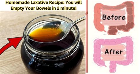 Effective Homemade Laxative Recipes for Constipation Relief - The Best ...