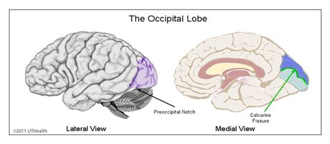 Pdf Occipital Lobe Morphological Anatomy Anatomical And Surgical | My ...