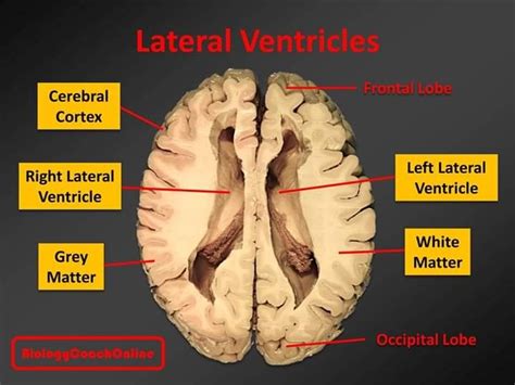 Last week's #MysteryAnatomy structure was the #lateral #ventricle. The ...