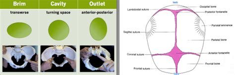 Asynclitism: a well aligned baby or a tilted head? | Dr Rachel Reed