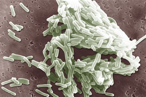 Listeria outbreak kills three adults in Washington state, health ...