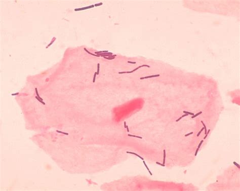 Lactobacillus - wikidoc
