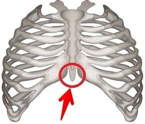 Rib Pain Icd 10 Code Guidelines and examples