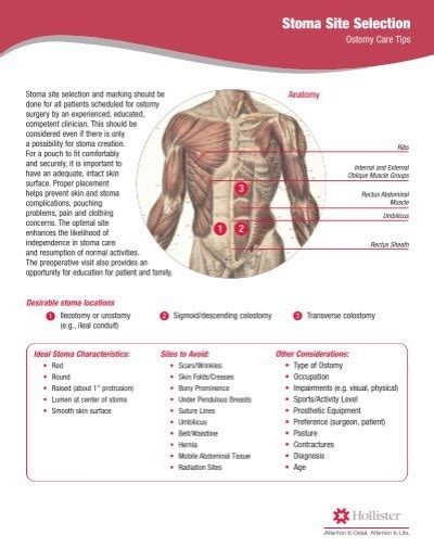 Stoma Site Selection - Hollister Incorporated