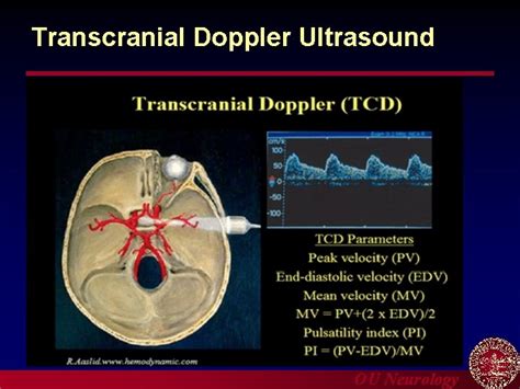 Introduction to Carotid Ultrasound and Transcranial Doppler Ultrasound