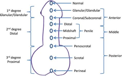 Urethral Orifice Anomaly - The Operative Review Of Surgery