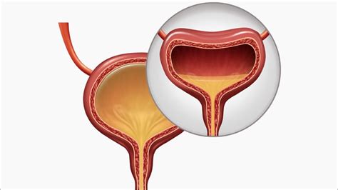 Fast Five Quiz: Overactive Bladder