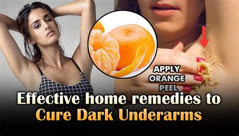 Effective home remedies to Cure Dark Underarms