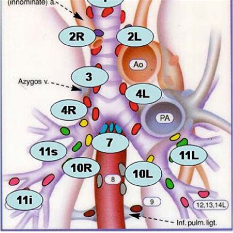 Chest Lymph Node Stations Ct - News Current Station In The Word