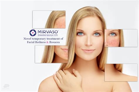 Facial Redness & Rosacea treatment with Mirvaso