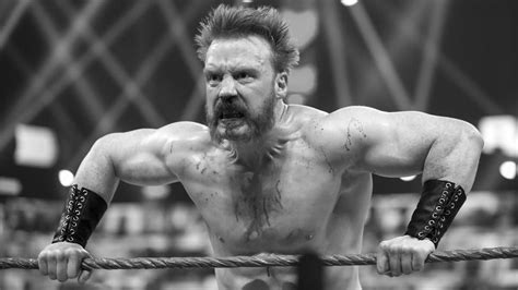 Sheamus Shows Off Gruesome Face Injury In New Hospital Photos - WrestleTalk