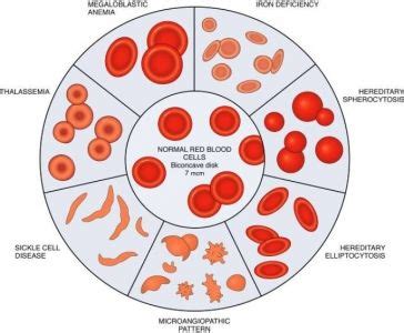 ANEMIA MENURUT MORFOLOGI ~ M. Azhari Rangkuti