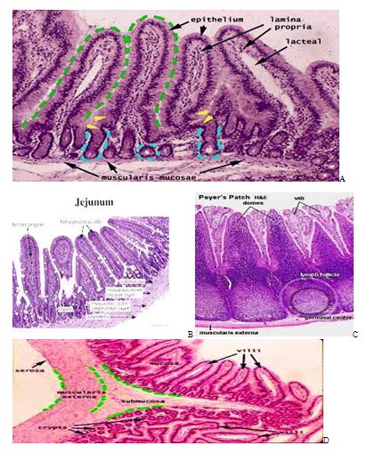 Histology Of Ileum Peyers Patches