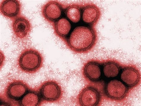 The Swine Flu Pandemic of 2009-2010 | Top Secret Writers