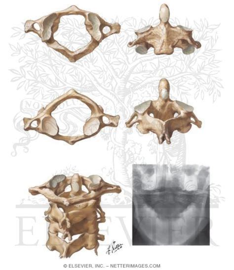 Cervical Vertebrae: Atlas and Axis Spine: Osteology