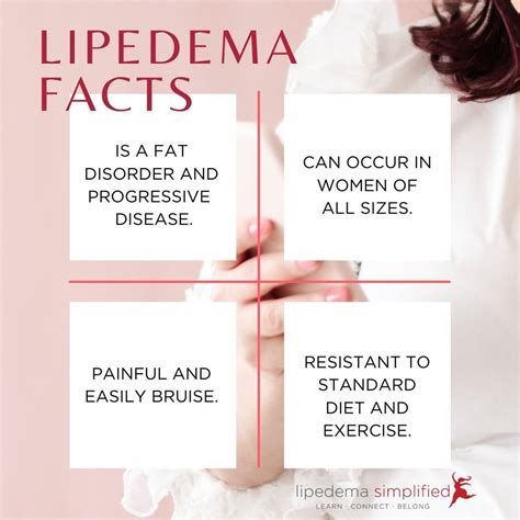 Simplified Lipedema Facts | Lipedema, Facts, Lymphedema