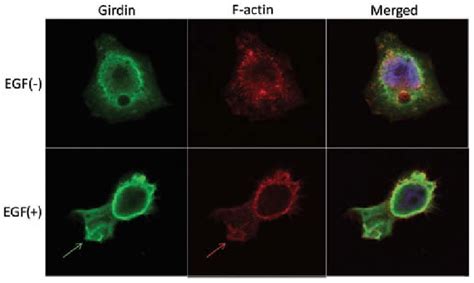 Girdin is involved in the formation of lamellipodia in epidermal growth... | Download Scientific ...