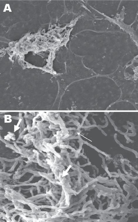 Scanning electron microscopy of Nocardia spp. bio fi lm on silicone... | Download Scientific Diagram