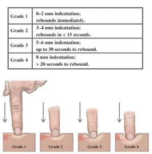 Skin: Palpation – Introduction to Health Assessment for the Nursing ...