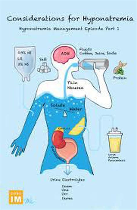 Causes of hyponatremia - MEDizzy