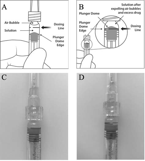 Injection technique with the aflibercept prefilled syringe (PFS). (A ...