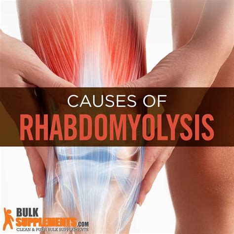 Rhabdomyolysis. Stop! Learn the Symptoms, Causes, & Treatment.