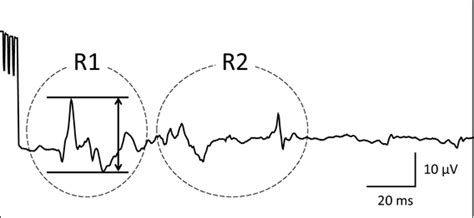 Example of the bulbocavernosus reflex. In the bulbocavernosus reflex,... | Download Scientific ...