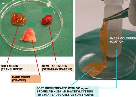 A show the appearance and texture of the three types (grades) of mucin ...