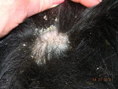 Dog Losing Hair Patches.How To Stop Dog Hair Loss. Dog Hair Loss What Causes It How To Prevent ...