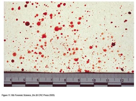 Blood Spatter Pattern Analysis – UCVision