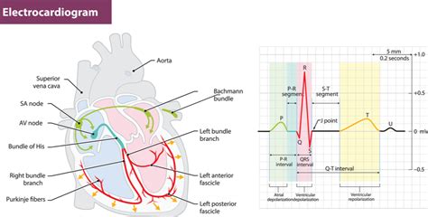 Electrocardiogram (EKG or ECG) | Eden Internal Medicine | Eden, NC