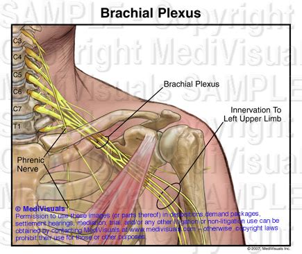 The Medical Legal Exhibit Expert Blog: Understanding the Brachial ...