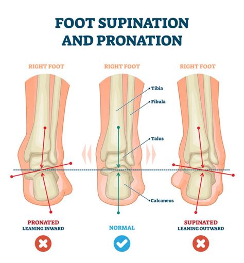 Ankle and Foot Pronation Exercises: Board Certified Podiatrists Katy TX